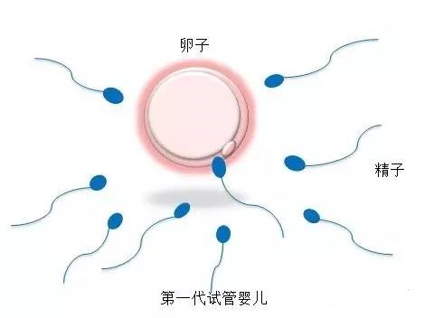 专业同志代怀助孕报价多少